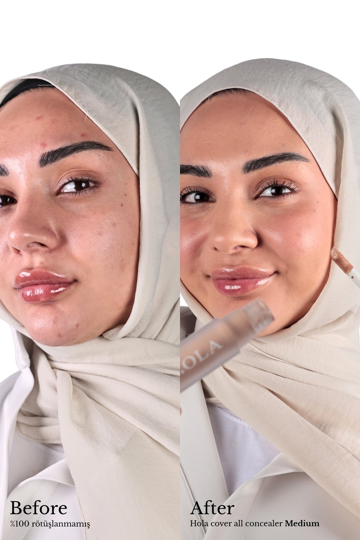 Full Coverage Concealer | Medium
